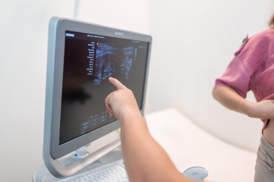 Ultraschallgerät während einer Untersuchung
