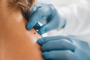 Dermatologie