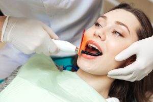 Zahnarzt führt Bleaching Behandlung durch